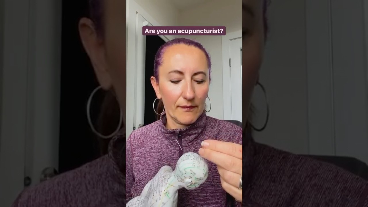 Acupuncture is Art 🎨