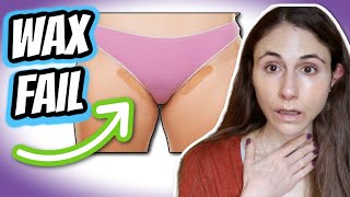 How to prevent HAIR WAXING FAILS | bumps, breakouts, redness, ingrown hairs, burns| Dr Dray