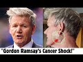 Gordon Ramsay Reveals Skin Cancer Diagnosis | Basal Cell Carcinoma Surgery Update