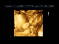 Voici mon fils esteban nicolas bernard dans le ventre de sa maman
