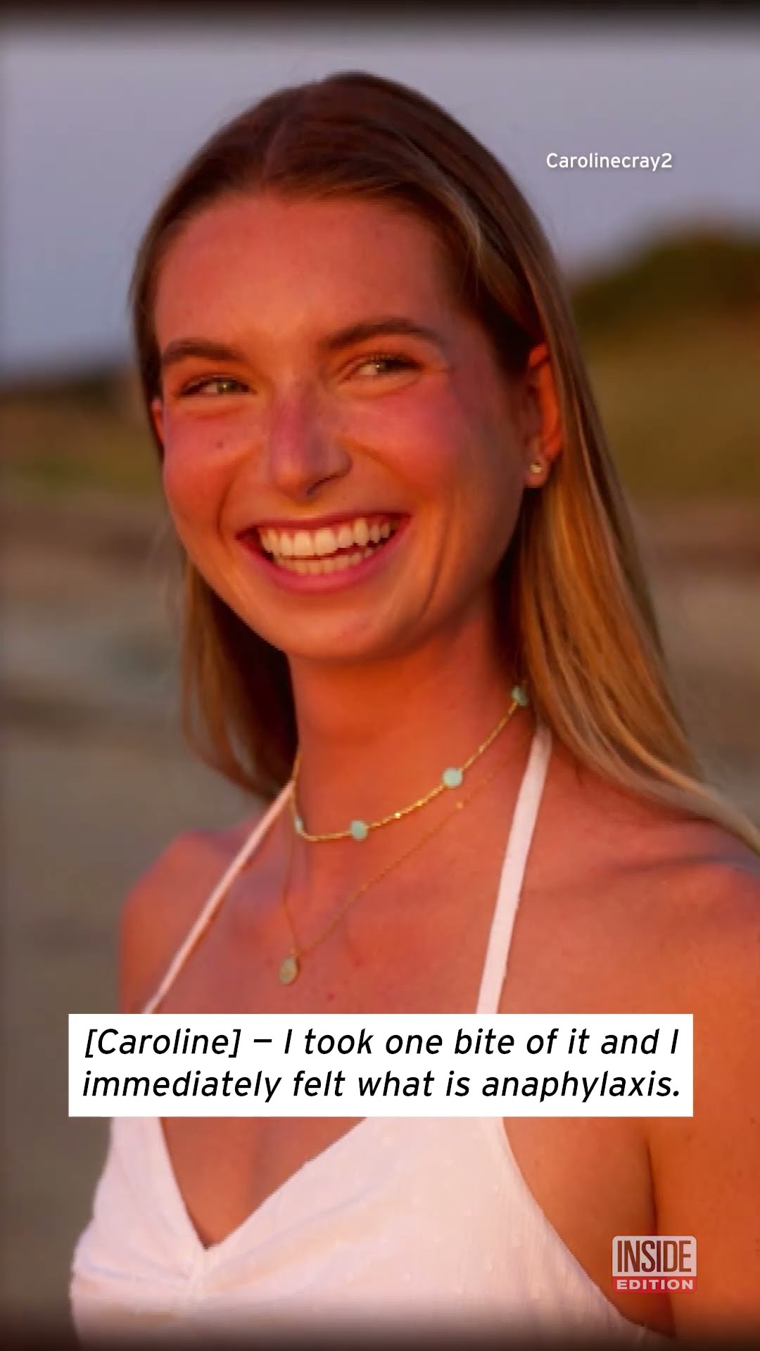 Woman Allergic to All But 2 Foods #shorts