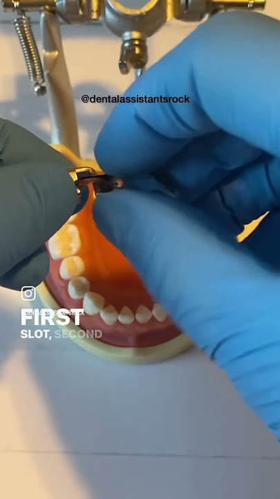Dental Assisting: How to assemble a matrix band #shorts #dental #trending