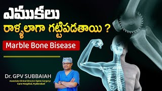 Causes of marble stone disease | Osteopetrosis | Health video | Dr GPV Subbaiah | Spine surgeon