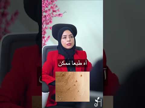 كيفيه التخلص من الزوائد الجلدية