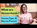 What Are Hemorrhoids? Types, Causes, and How to Prevent Them (2021)