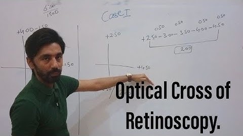 Optical Cross in Retinoscopy/ Gross & Net Retinoscopy