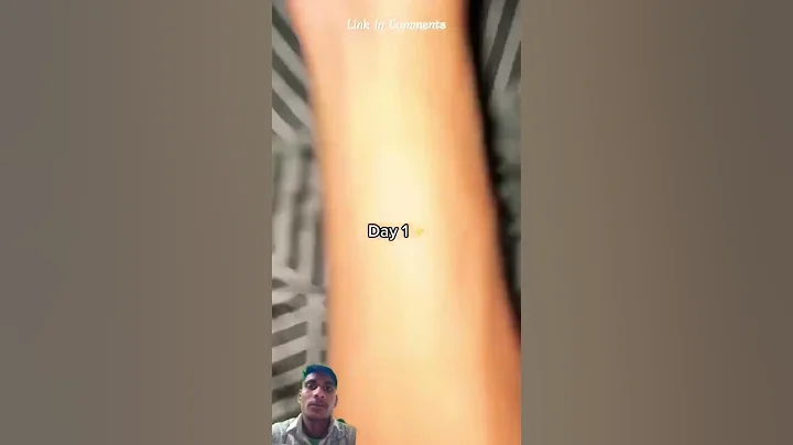 Using Hand Gripper For 30days (Insane Result) Link In Comments #shorts #handgripper