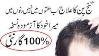 Ganjpan Ka Ilaj Kasay Karay Ganjapan Katam Karnay Ka Tareka Baldness Treatment At Home