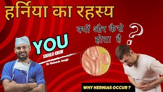 हर्निया  का  रहस्य : क्यों  और  कैसे  होता   है ? || The Story Behind Hernia! 👀