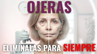 ¡Adiós BOLSAS bajo los ojos! SECRETOS de un Experto ‍