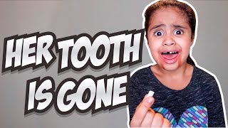 HER TOOTH IS GONE *revenge prank*