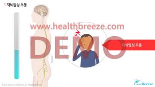 [Demonstration] b0003aako_Cerebrospinal Fluid Examination Guide (Adult)