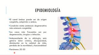 Estenosis del canal lumbar ¿Cuándo operar?