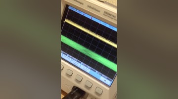 ECE230: Lab 8 Common Drain Amplifier and Multistage Amplifier Lab