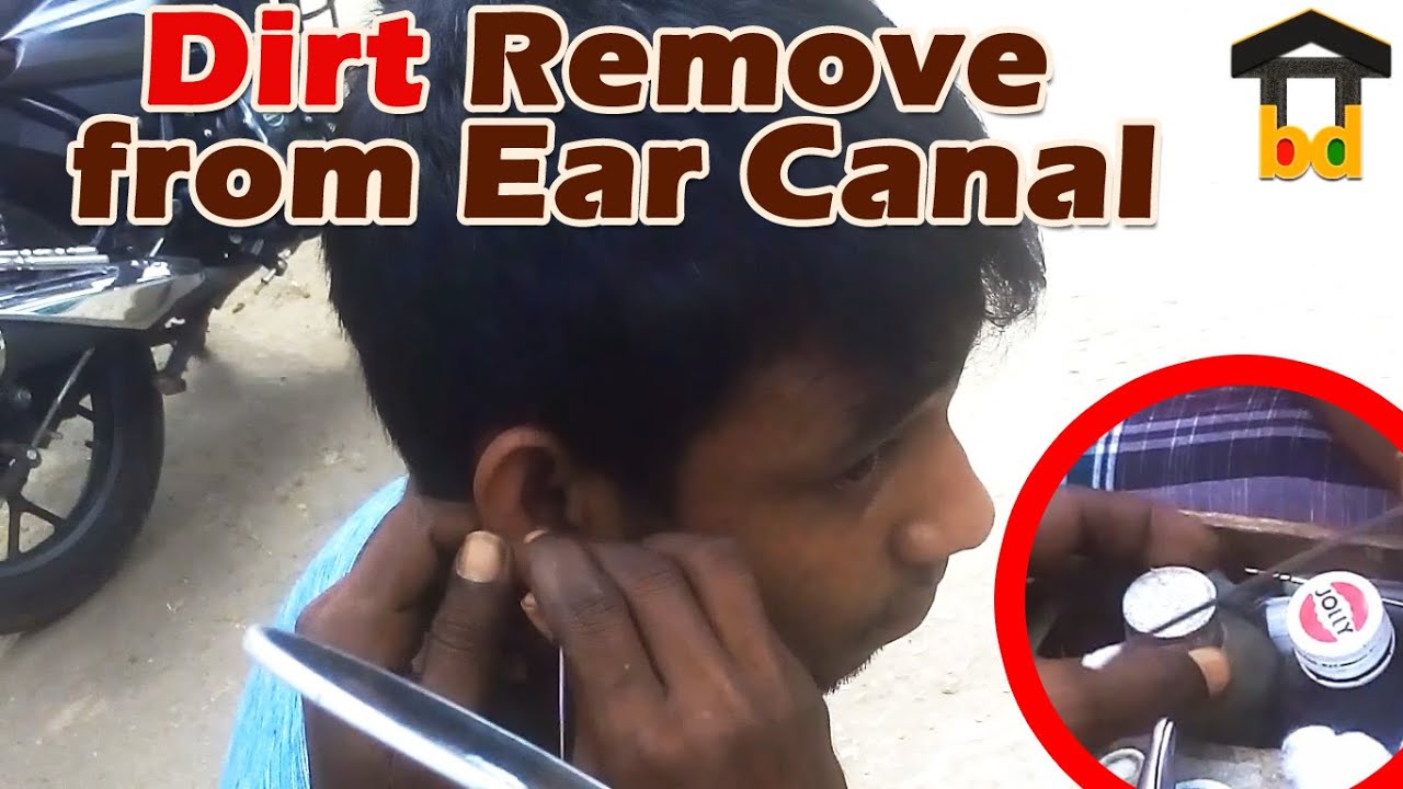 Village Guys Ear Waxing in General Way Using Traditional Method II