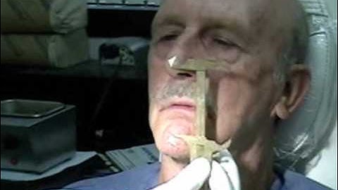 Dentures - Wax Rim Appointment - Wax esthetics, speech, CR, VDO