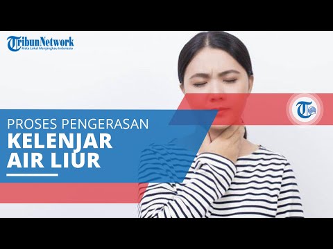 Video: Adakah sialolithiasis hilang?