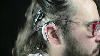 Dale's journey with a cochlear implant