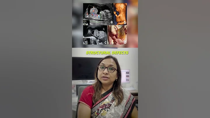 Anomaly Scan: The Most Important Pregnancy Test You Didn’t Know About! #ntscan #anomaly #ultrasound