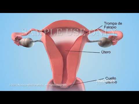 Vídeo: Relación Entre Las Semogelinas Unidas Al Esperma Humano Y Otros Parámetros Del Semen Y Los Resultados Del Embarazo
