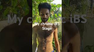 Chronic ibs stage #ibs #ibsstory#guthealth