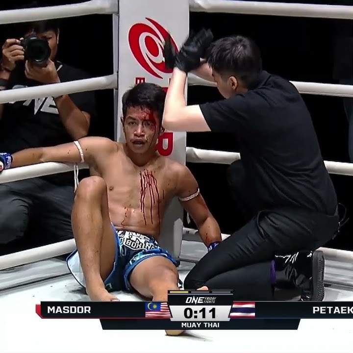 HELLBOW 💪 Rifdean Masdor busts open Petaek with a fight-ending elbow!
