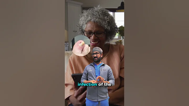 Thick Nails or a Wound by Your Toe? It Could Be a Circulation Issue 🦶