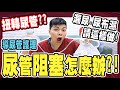 尿管阻塞 沉澱物好多 可能少了這動作 導尿管護理 每日扭轉尿管 保持管路通暢最重要 小護士不要跑 尿管阻塞 沉澱物好多 可能少了這動作 導尿管護理 每日扭轉尿管 保持管路通暢最重要 小護士不要跑