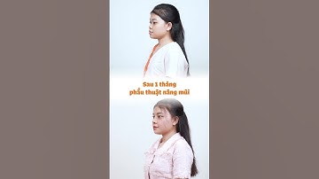 Short video|Cải thiện khuyết điểm mũi thấp để tự tin hơn