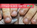 ГРЫЗУНЧИК🤢НОГТЕЙ ПОЧТИ НЕ ОСТАЛОСЬ 🤯😱