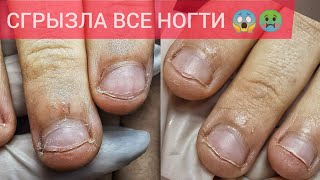 ГРЫЗУНЧИК🤢НОГТЕЙ ПОЧТИ НЕ ОСТАЛОСЬ 🤯😱