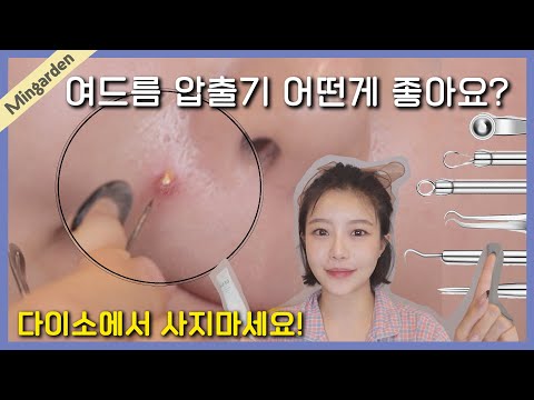 <strong>여드름</strong> 흔적 없이 압출하는법✨여드름에 따른 <strong>압출기</strong> 선택법! 뾰루지 같이짜요!😆