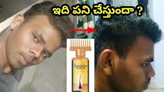 Does indulekha works  //మీరు అడిగిన comments కి answers  //does onion juice works