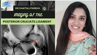 Imaging of Posterior Cruciate Ligament | Dr Chaitali Parekh | MRI Knee | Knee Pain Imaging