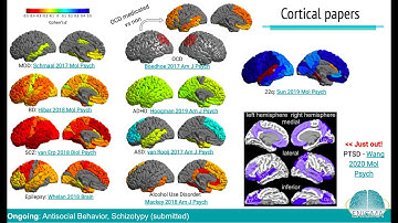 ENIGMA, Big Data & the Brain: Neuroimaging of Brain Diseases in 100,000 People from 45 Countries