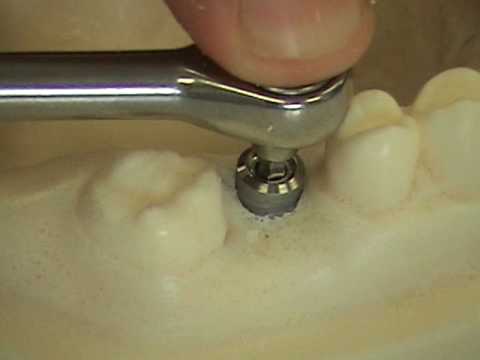 Dental Implants Course Video Part 2