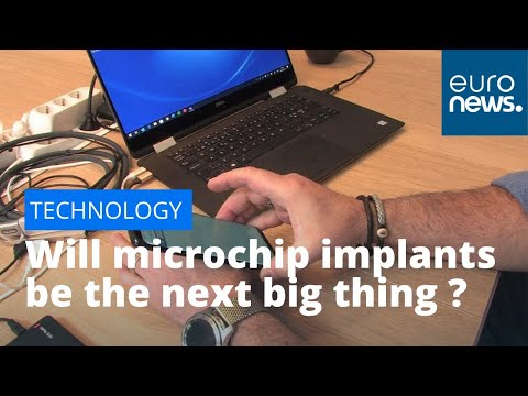 Will microchip implants be the next big thing in Europe?