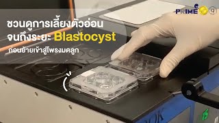 การเลี้ยงตัวอ่อนจนถึงระยะ Blastocyst ก่อนย้ายเข้าสู่โพรงมดลูก | Prime Fertility Clinic