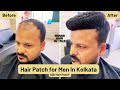 Transform Your Look with the Best Hair Patch for Men in Kolkata and Durgapur | Indian Hair World