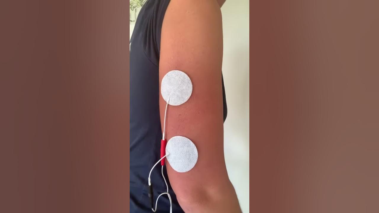 electrode placement for russian electrical stimulation for shoulder and  elbow - Yahoo Image Search Results