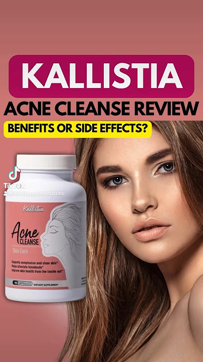Kallista acne cleanse review #skincareroutine