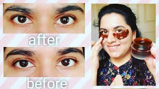 DIY Eye Mask! Get rid of DARK CIRCLES, PUFFINESS, FINE LINES, WRINKLES, UNDER EYE BAGS!! by Aishwarya Overby 305 views 3 years ago 2 minutes, 20 seconds