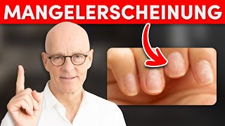 Das sagen Fingernägel über deine Gesundheit aus! (erstaunlich)