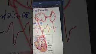 Esto Es Importante Si Tienes Extrasistoles Ía