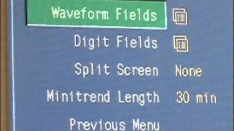 C15_IndirectCalorimetry.wmv