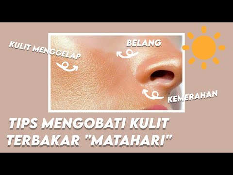 CARA MEMULIHKAN KULIT TERBAKAR MATAHARI | TIPS MENGOBATI KULIT TERBAKAR MATAHARI SECARA ALAMI