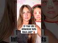 17-Year-Old Influencer Gets Nose Job? #shorts #piperrockelle #surgery