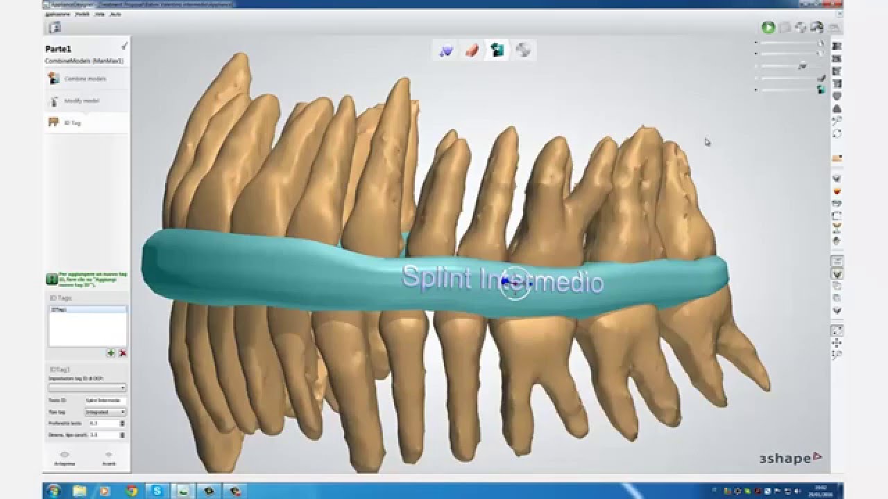 Surgical Splint "Middle" YouTube