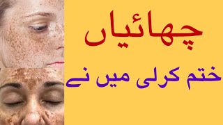 Freckles and dark spots treatment at home| How to remove dark spots on face naturally |