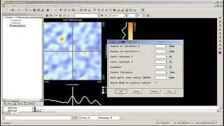 Introduction to Human Eye Simulations in ASAP